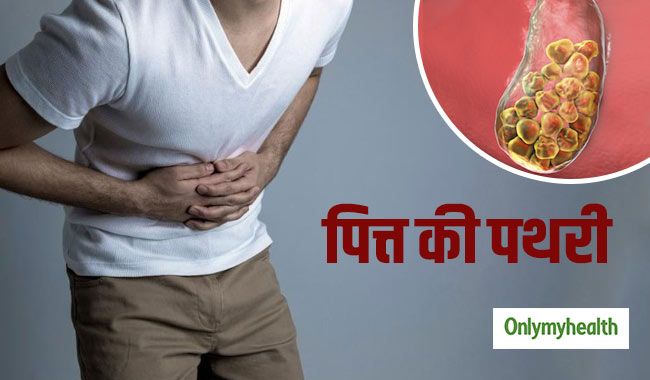 जानें क्यों होती है पित्त की पथरी और किन आहारों से करना चाहिए परहेज