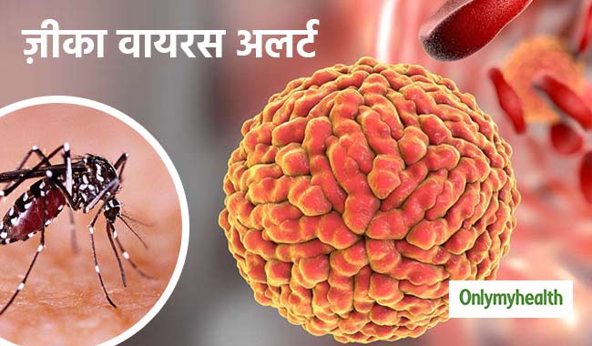 राजस्थान में ज़ीका वायरस से 22 लोग संक्रमित, तेजी से फैलती है ये खतरनाक बीमारी