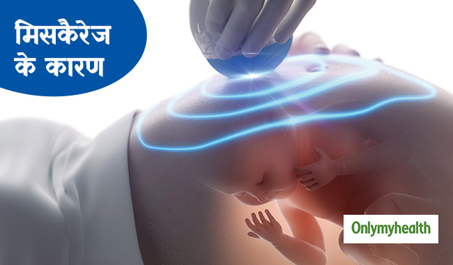 क्यों होता है महिलाओं का मिसकैरेज? जानें इसके मुख्य कारण और बचाव के तरीके