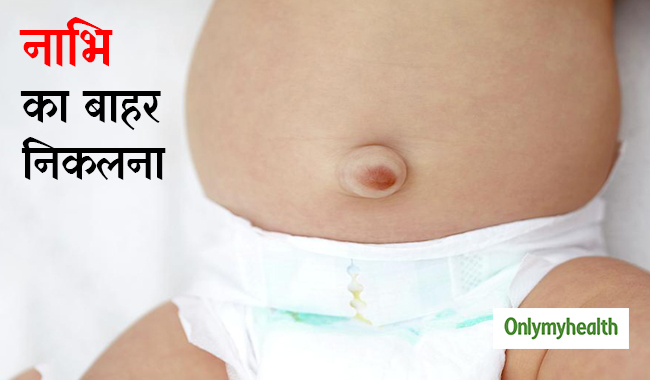 शिशुओं में नाभि का बाहर निकलना हो सकता है अम्बिलिकल हर्निया, जानें कारण