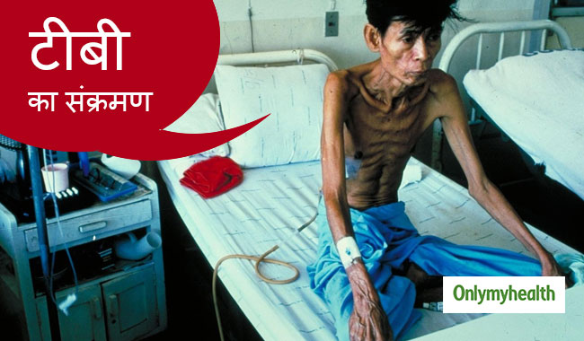 टीबी है विश्व का सबसे खतरनाक संक्रामक रोग, जानें कितन हैं इसके रोगी