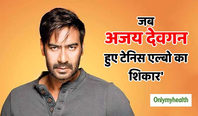 Ajay Devgn Birthday: जब अजय देवगन हुए 'टेनिस एल्बो' का शिकार, जानें क्यों खतरनाक है ये रोग