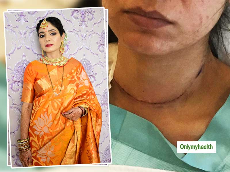 थायराइड कैंसर को मात दे चुकी है ये महिला, जानें इसकी पूरी कहानी