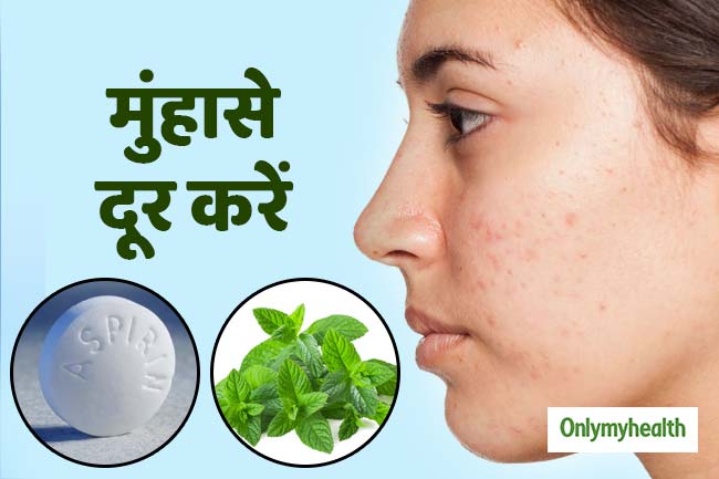 मुहांसों को हटाने के तरीके
