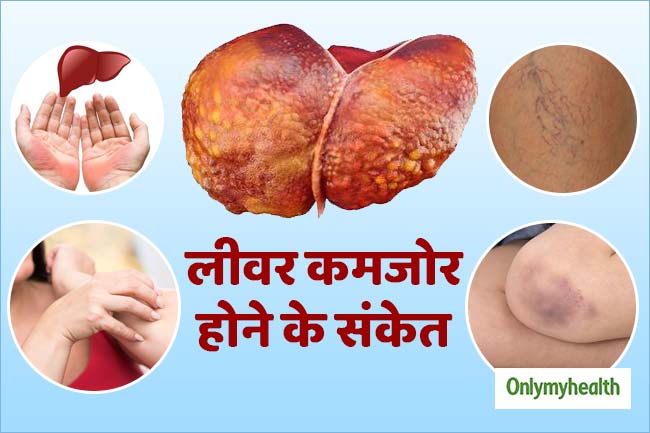 लिवर कमजोर होने पर देता है संकेत