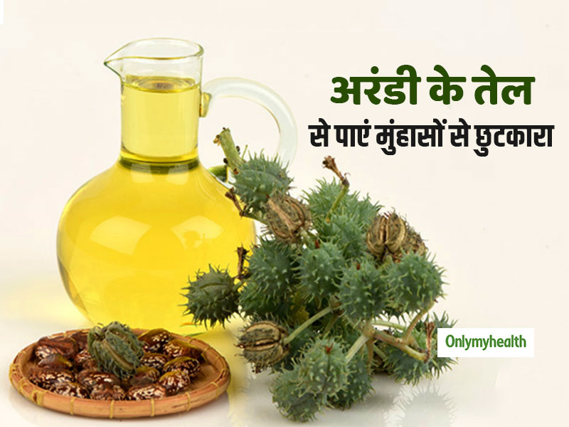 अरंडी के तेल से 2 हफ्तों में पाएं मस्सों और मुहासों से छुटकारा, जानें प्रयोग का तरीका