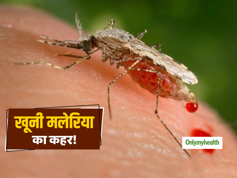 Malaria Fever: खूनी मलेरिया की चपेट में कानपुर शहर! अस्पतालों में बढ़े मरीज, जानें इससे बचाव के उपाय
