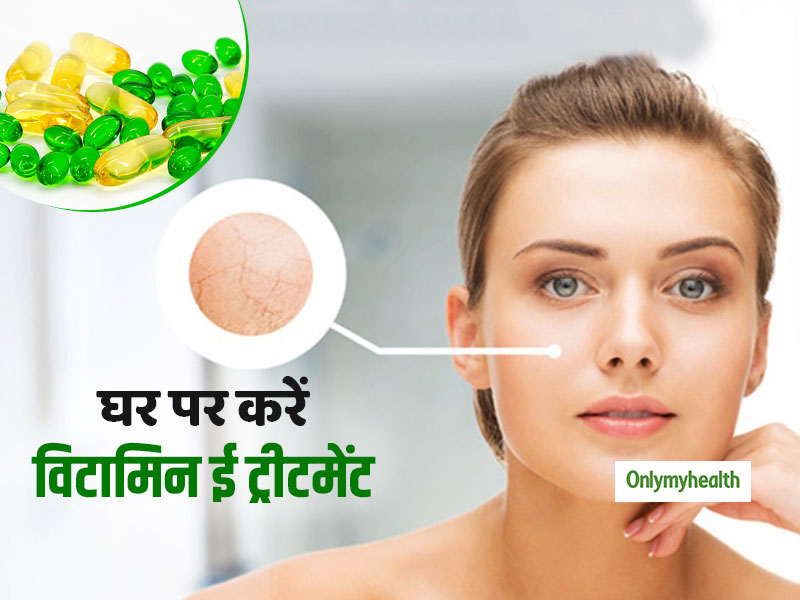 स्किन के लिए बेस्ट है विटामिन E ट्रीटेमेंट, खूबसूरत-बेदाग चेहरे के लिए इन 3 तरीकों से करें इस्तेमाल