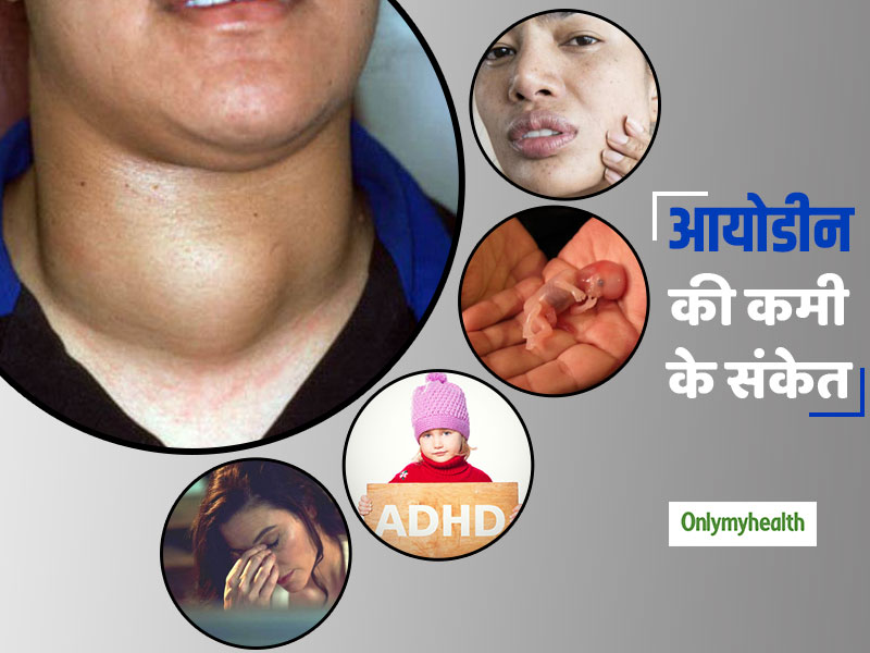 World Iodine Deficiency Day: शरीर में चुपके से होने वाले ये 7 बदलाव आयोडीन की कमी के हैं संकेत