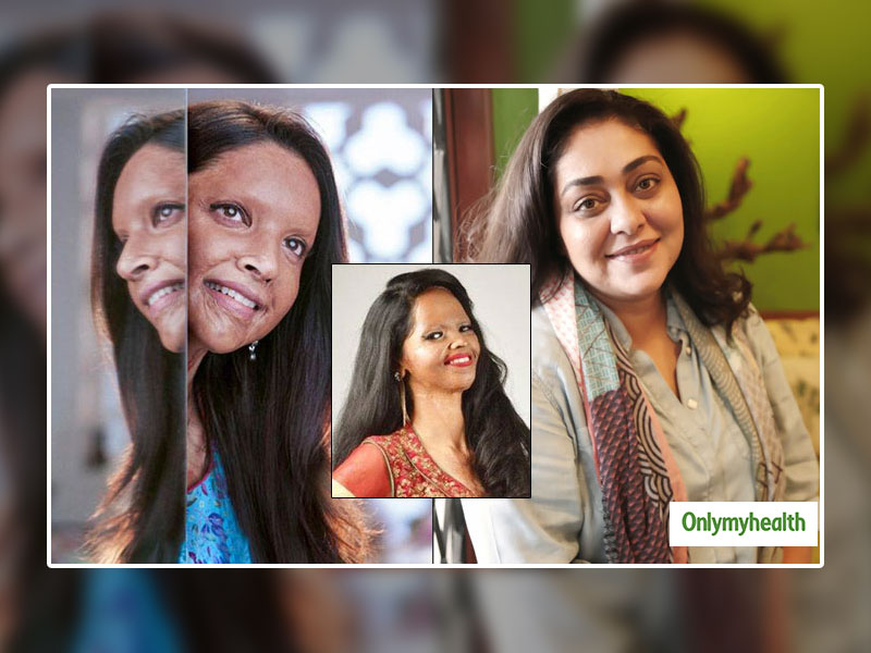 दीपिका पादुकोण की एसिड अटैक पर बनी फिल्म 'छपाक' हुई रिलीज, जानें एसिड गिरने पर क्या हो फर्स्ट एड