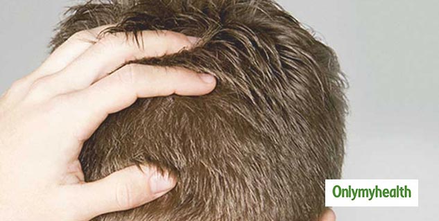 hair transplant