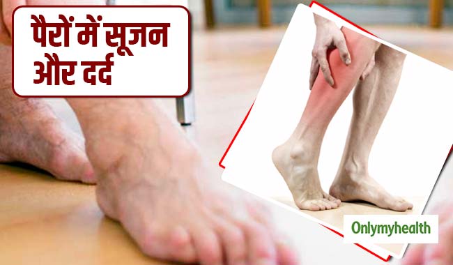 हाथ और पैरों की नसों में दर्द और सूजन हो सकता है डीवीटी रोग का संकेत