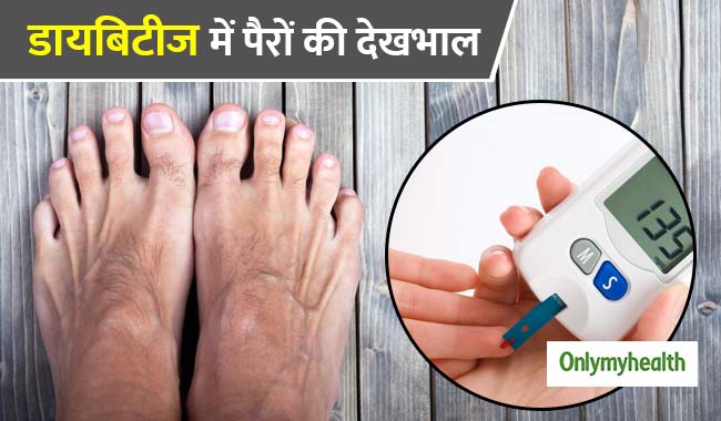 डायबिटीज में बंद हो सकती है पैरों में खून की सप्लाई, बदल जाती है त्वचा की रंगत