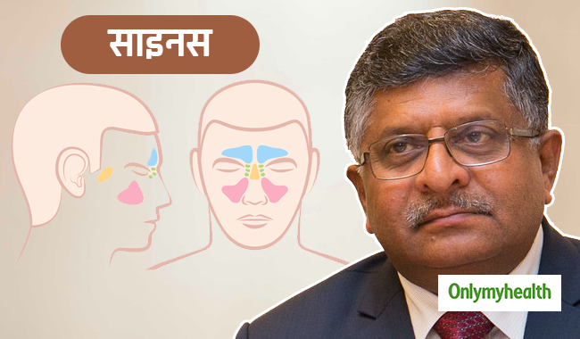 बीजेपी नेता रविशंकर प्रसाद को हुआ साइनस, जानें सर्दियों में क्यों बढ़ जाता है इस रोग का खतरा