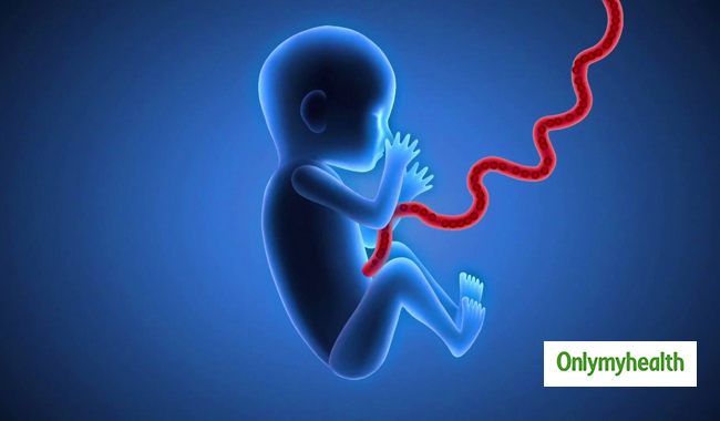 गर्भनाल का बढ़ना बच्चे के लिए है खतरनाक, जानें इससे जुड़ी महत्वपूर्ण जानकारी