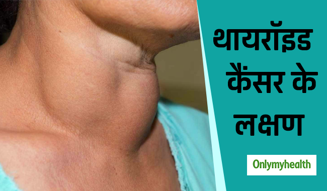 गले में होने वाली ये 9 परेशानियां हो सकती हैं थायरॉइड कैंसर का शुरुआती संकेत, जानें इलाज