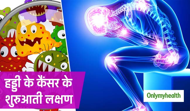 बहुत सामान्य हैं 'हड्डी के कैंसर' के शुरुआती संकेत, जोड़ों में दर्द और सूजन दिखे तो बरतें सावधानी