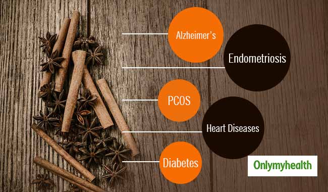 How to Beat PCOS, Endometriosis, and More with Cinnamon 