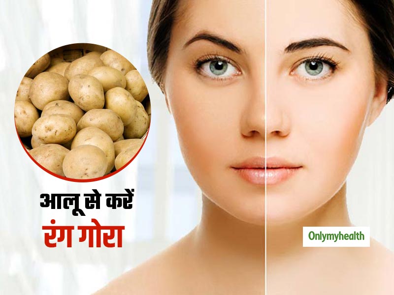 डार्क स्पॉट को दूर करने में फायदेमंद है आलू, जानें चेहरे पर कैसे लाए निखार