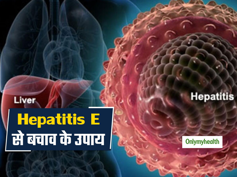 Hepatitis E: इस मानसून हेपेटाइटिस ई से खुद को बचाने के लिए अपनाएं कुछ सरल उपाय