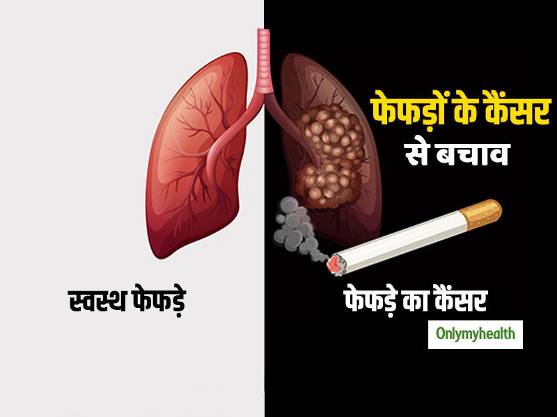 फेफड़ों के कैंसर से हर साल मरते हैं 60 लाख लोग, वजह है तम्बाकू! एक्सपर्ट से जानिए कैंसर के बचाव
