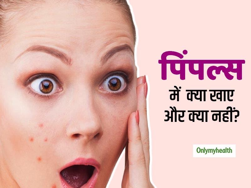 चेहरे पर पिंपल्स का कारण हो सकता है गलत खानपान, जानें पिंपल्स रोकने के लिए क्या खाएं, क्या नहीं?