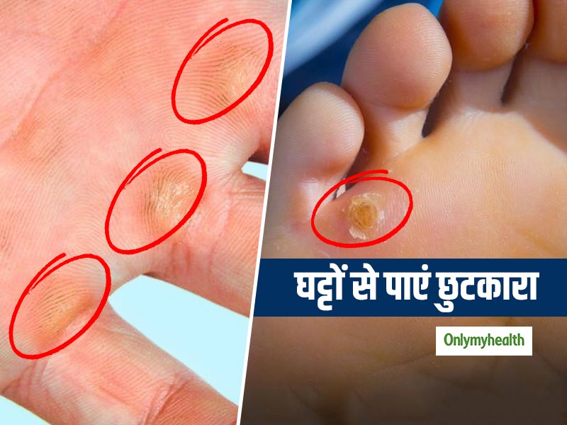 हाथ-पैरों में पड़ने वाले घट्टों को करना है साफ, तो ऐसे करें नींबू और ब्रेड का प्रयोग