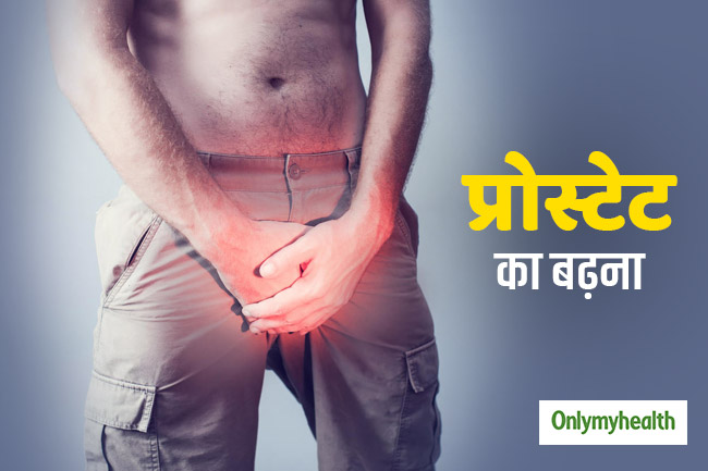 प्रोस्टेट ग्रंथि का बढ़ना
