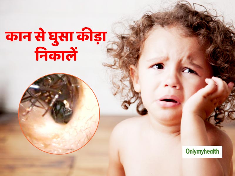 कान में चला गया है कीड़ा तो इन 4 आसान तरीकों से निकालें बाहर, नहीं होगा दर्द