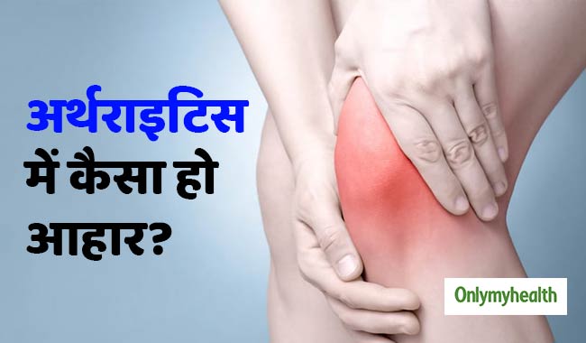 खान-पान में बदलावों के द्वारा कर सकते हैं अर्थराइटिस को कंट्रोल, जानें कैसे?