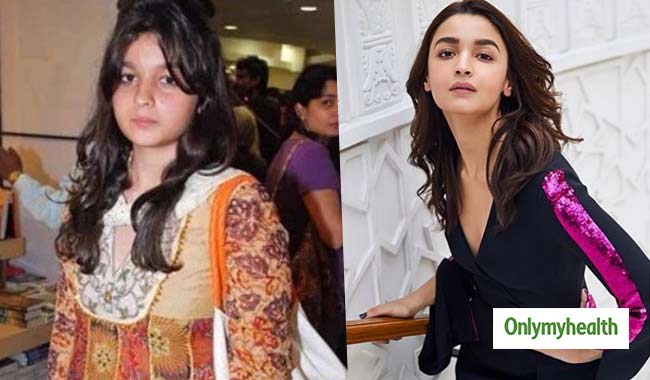 Alia Bhatt Birthday Special: जानें आलिया ने कैसे सिर्फ 3 महीने में 16 किलो वजन घटाया