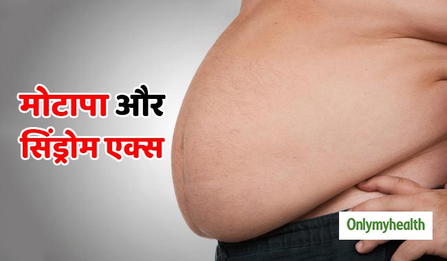 स्टडी : सिर्फ मोटापे के कारण नहीं होता सिंड्रोम एक्स, जानिए इसके बारे में
