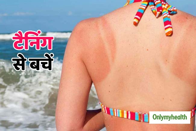 टैनिंग की चिंता