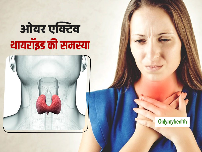 ये 6 लक्षण बताते हैं कि ओवर-एक्टिव हो गया है आपका थायरॉइड, जानें क्या है हायपरथायरॉइडिज्म