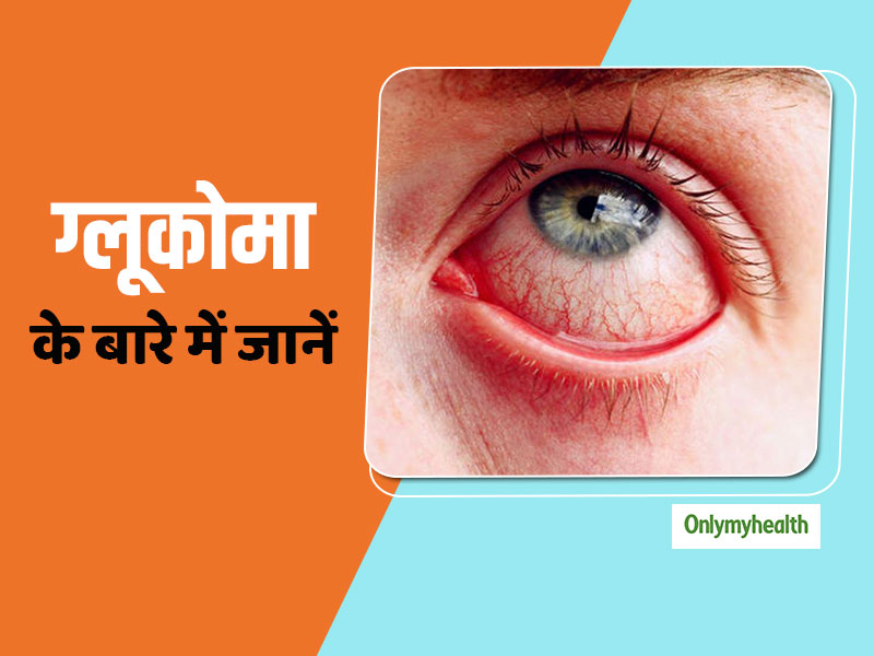 आंखों का खतरनाक रोग है ग्लूकोमा (काला मोतियाबिंद), नजरअंदाज करने पर बन सकता है अंधेपन का कारण