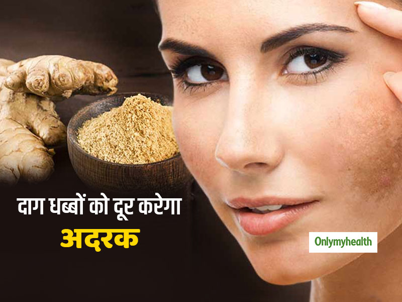 फ्लॉलेस स्किन पाने के लिए अब फेशियल की जरूरत नहीं, घर पर अदरक से बनाएं नैचुरल टोनर और फेस पैक