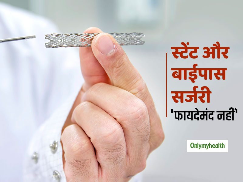 हार्ट अटैक के मरीजों के लिए क्यों फायदेमंद नहीं स्टेंट और बाईपास सर्जरी, जानें शोधर्ताओं की राय