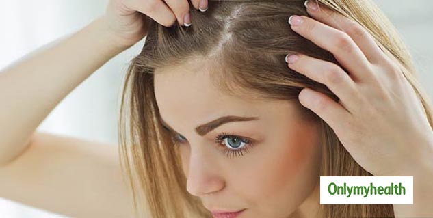 Bay Leaf For Dandruff