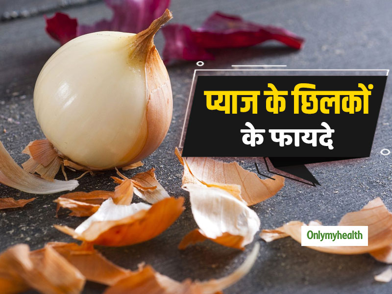 प्याज के छिलकों को इस तरह इस्तेमाल करने से बढ़ती है बालों की लंबाई, दूर होती है त्वचा की समस्या