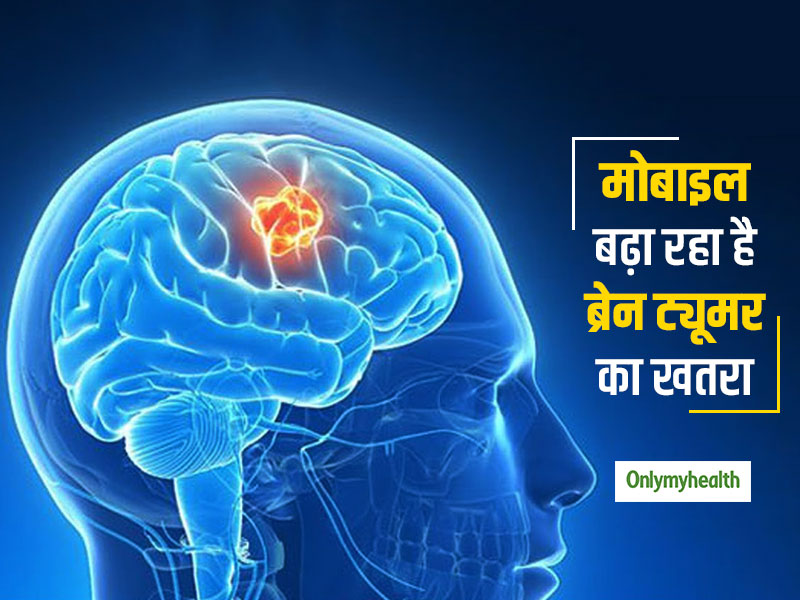 World Brain Tumor Day: मोबाइल फोन के इस्तेमाल से बढ़ रहे हैं ब्रेन ट्यूमर के मामले, बेहद सामान्य हैं लक्षण