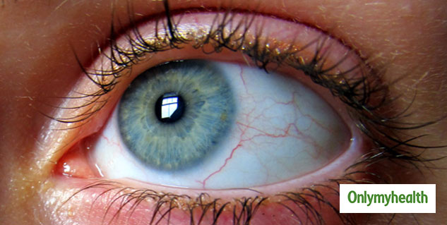 Inside_DOTONEYESDISEASES