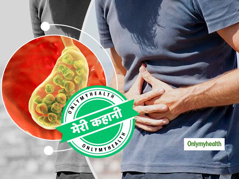 सच्ची घटना: गालस्टोन (पित्ताशय की पथरी) से पीड़ित नरेन को कैसे मिली इस समस्या से आजादी, पढ़ें पूरी कहानी