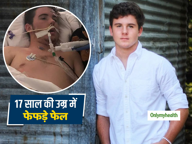 Lung Failed: 17 साल की उम्र में एथलीट के फेफड़े हुए फेल, जानें फेफड़े फेल होने के कारण और लक्षण