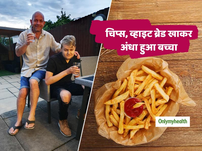 10 साल से चिप्स, बर्गर खा रहा 17 साल का बच्चा हुआ अंधा और बहरा, डॉक्टरों ने बताई ये वजह