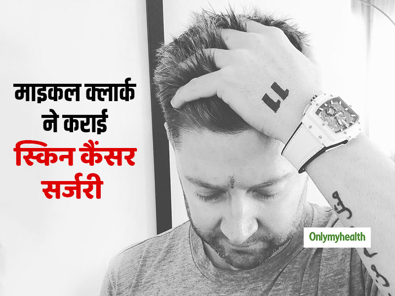 Michael Clarke Skin cancer: माइकल क्लार्क ने कराई स्किन कैंसर की चौथी सर्जरी, युवाओं को दी ये खास सलाह