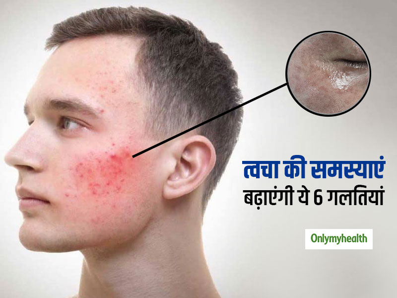 रोजाना की ये 6 गलतियां बढ़ाती हैं एलर्जी और इंफेक्शन का खतरा, सेंसिटिव स्किन वाले रहें सावधान