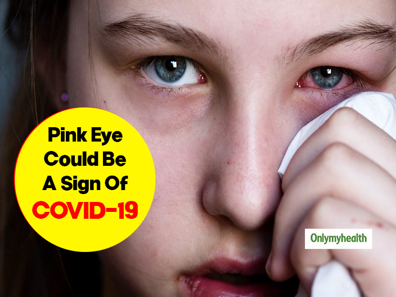 Is Pink Eye A Potential Symptom Of Coronavirus? Know How Tears May Spread The Infection
