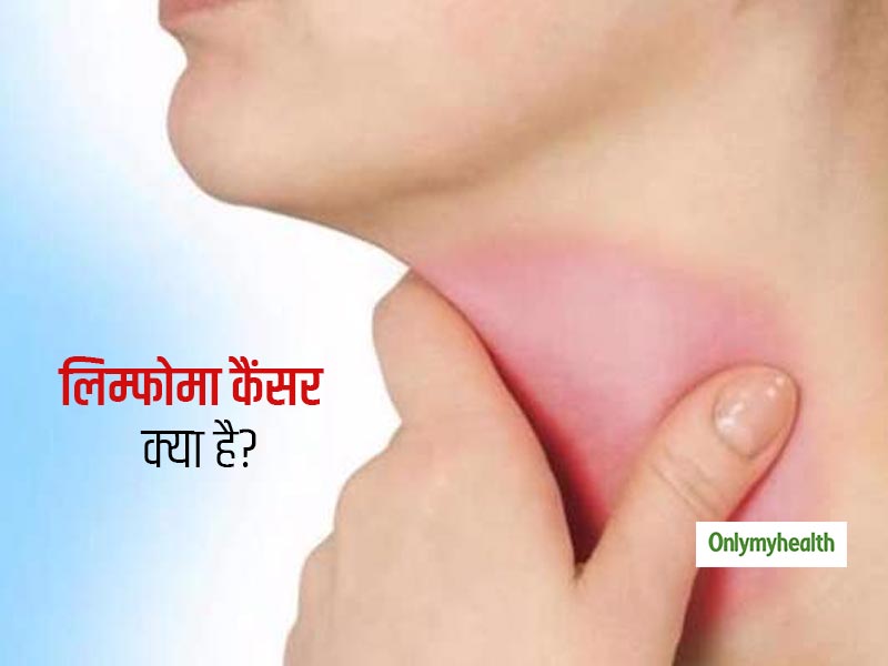 गले में सूजन और दर्द हो सकता है लिम्फोमा कैंसर का संकेत, जानें इसके लक्षण और कारण