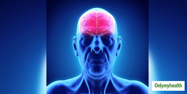 various_types_of_dementia