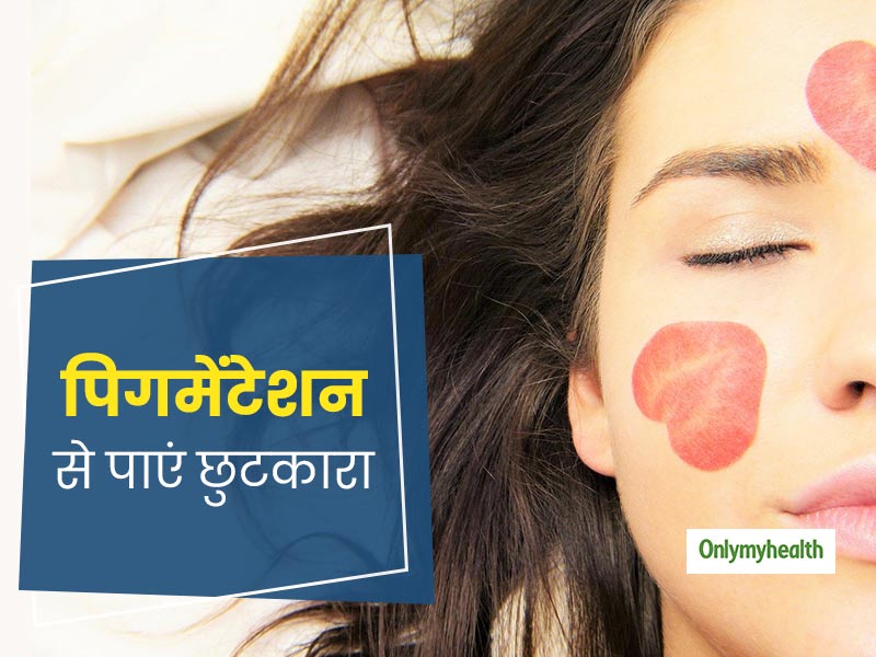 शहद और एलोवेरा को मिलाकर लगाने से दूर होती है पिगमेंटेशन की समस्या, जानिए इस्तेमाल करने का तरीका